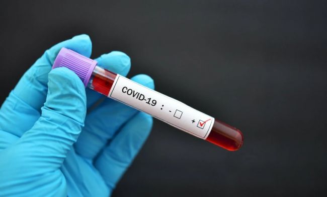Немецкий ученый заявил, что лабораторное происхождение коронавируса доказано